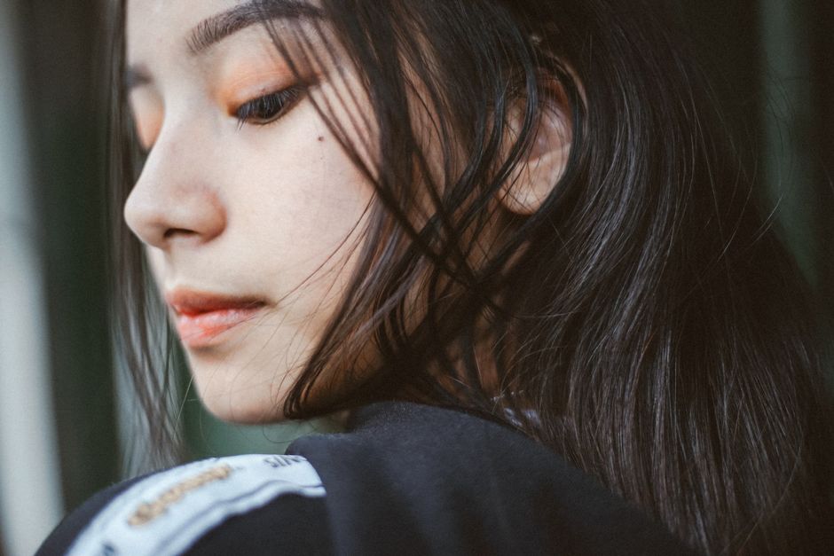 Minh họa các loại nám da: biểu bì, trung bì, hỗn hợp