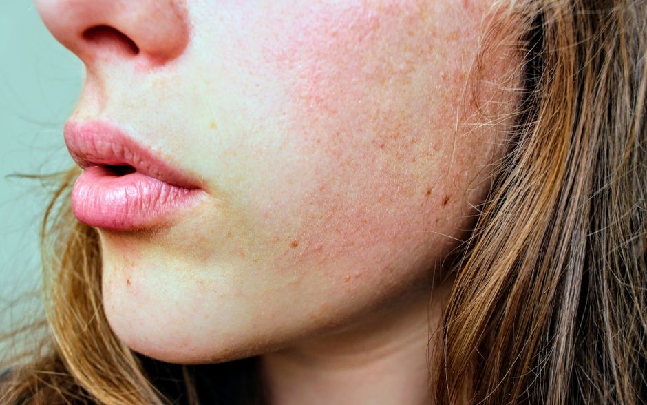 Bí quyết chọn sữa rửa mặt phù hợp: Lời khuyên từ BS. Bùi Nguyễn Thục Đoan