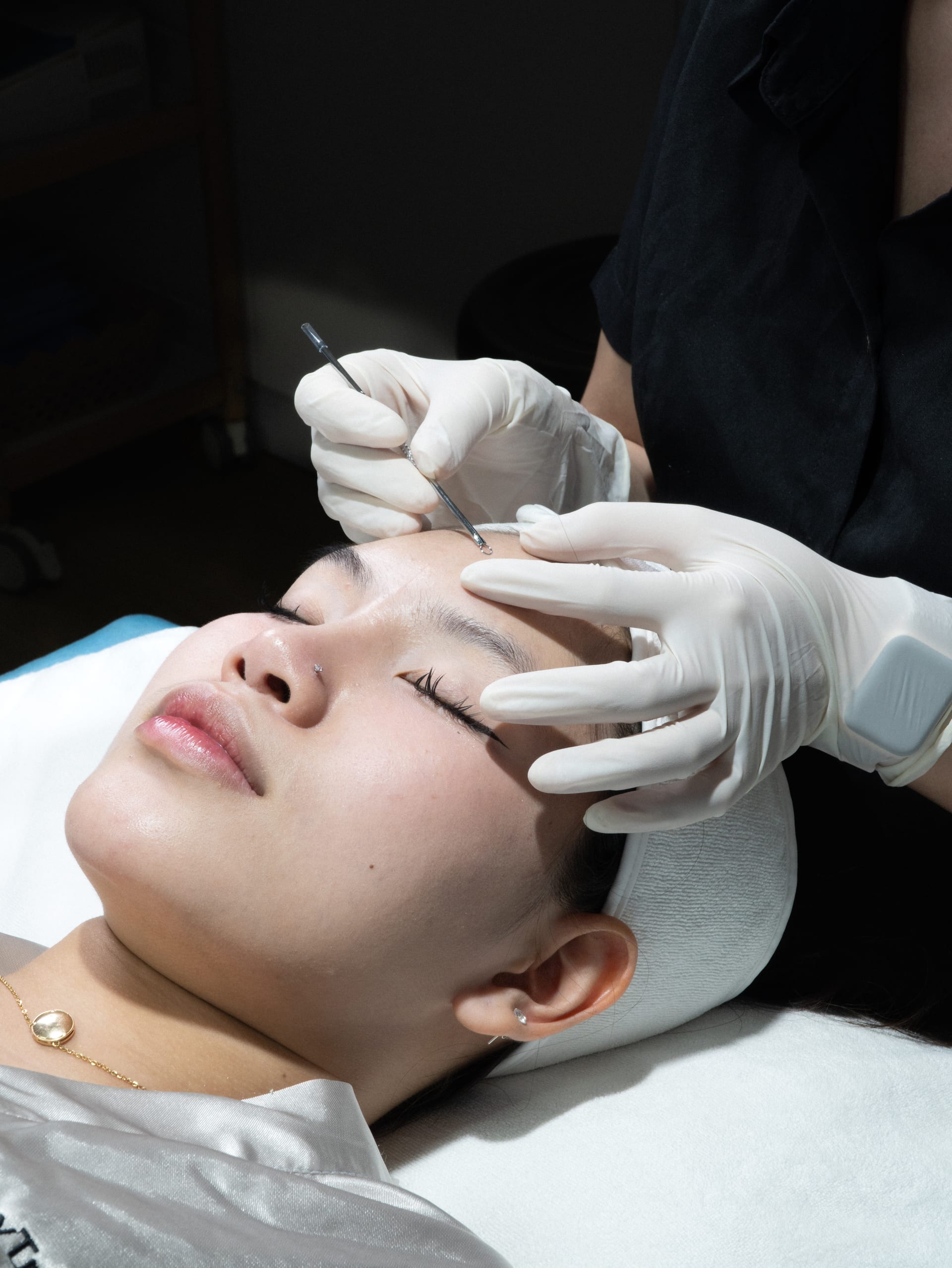 Điều trị mụn