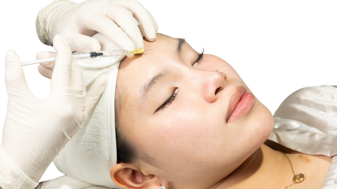Cấy Collagen