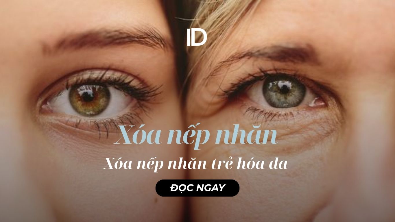 Xóa nếp nhăn khuôn mặt – Trẻ hóa da toàn phần