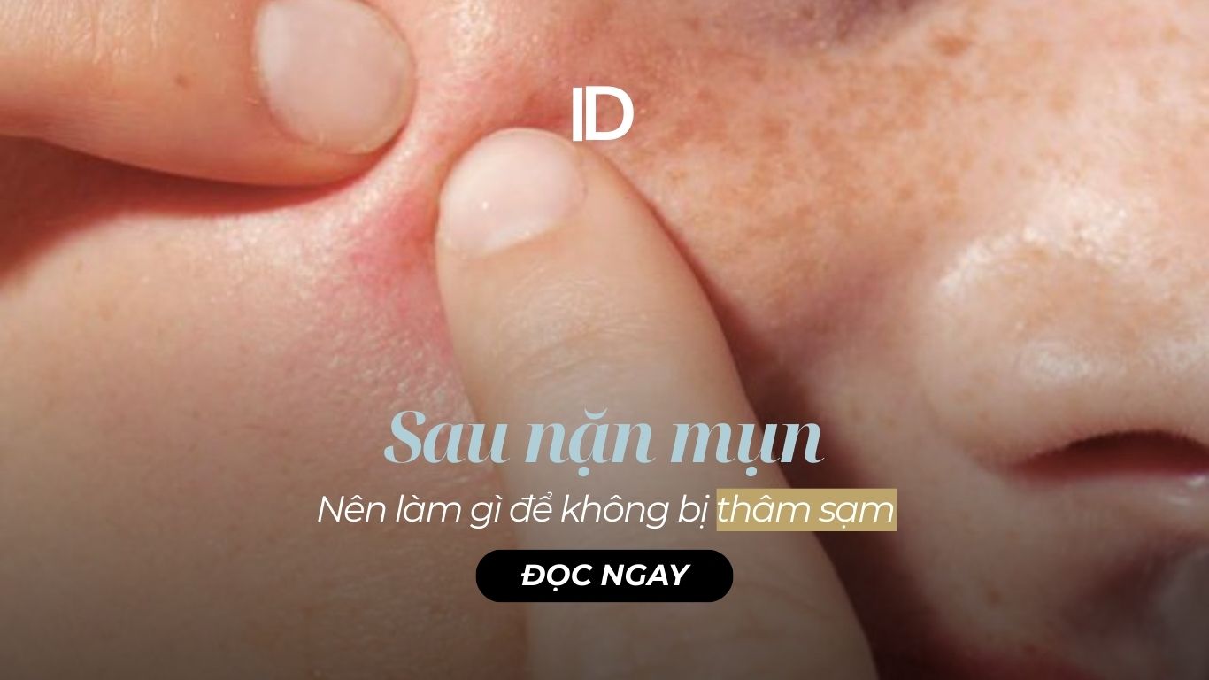 SAU NẶN MỤN THÌ NÊN LÀM GÌ ĐỂ KHÔNG BỊ THÂM?