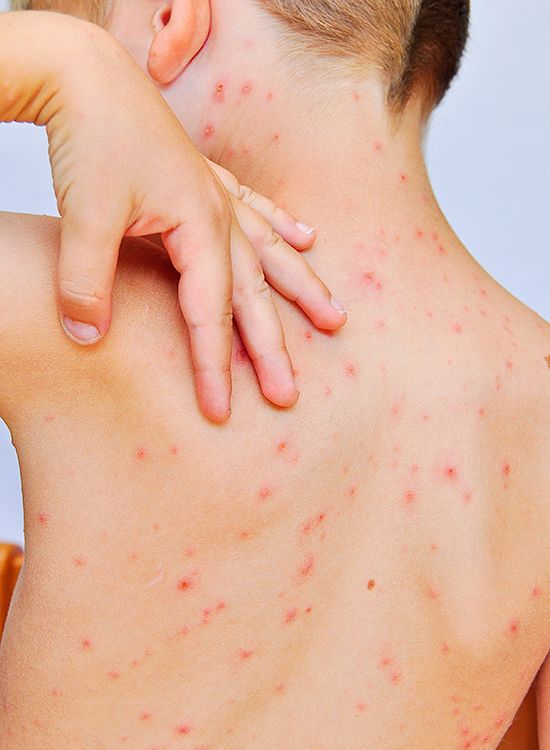 How-to-identify-a-skin-rash