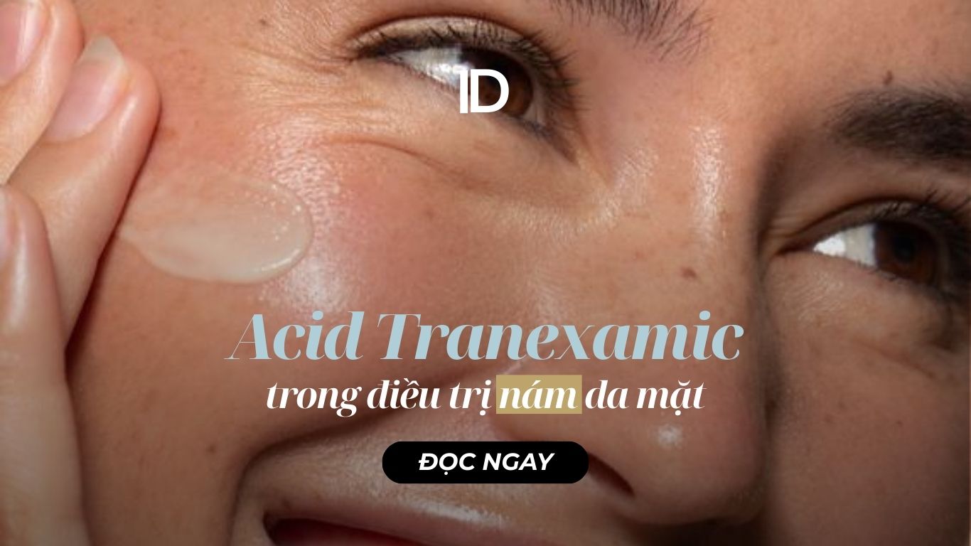 ACID TRANEXAMIC TRONG ĐIỀU TRỊ NÁM DA MẶT
