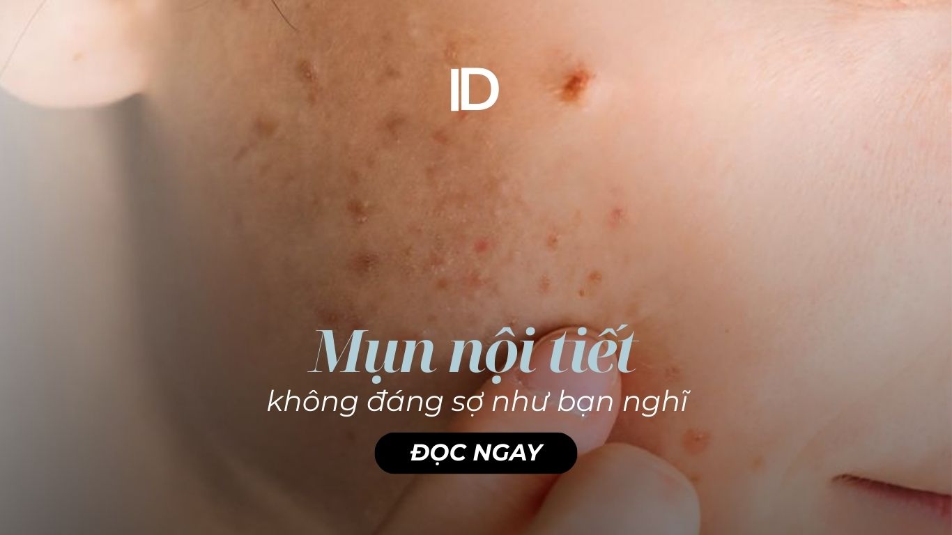 MỤN NỘI TIẾT KHÔNG ĐÁNG SỢ NHƯ BẠN NGHĨ