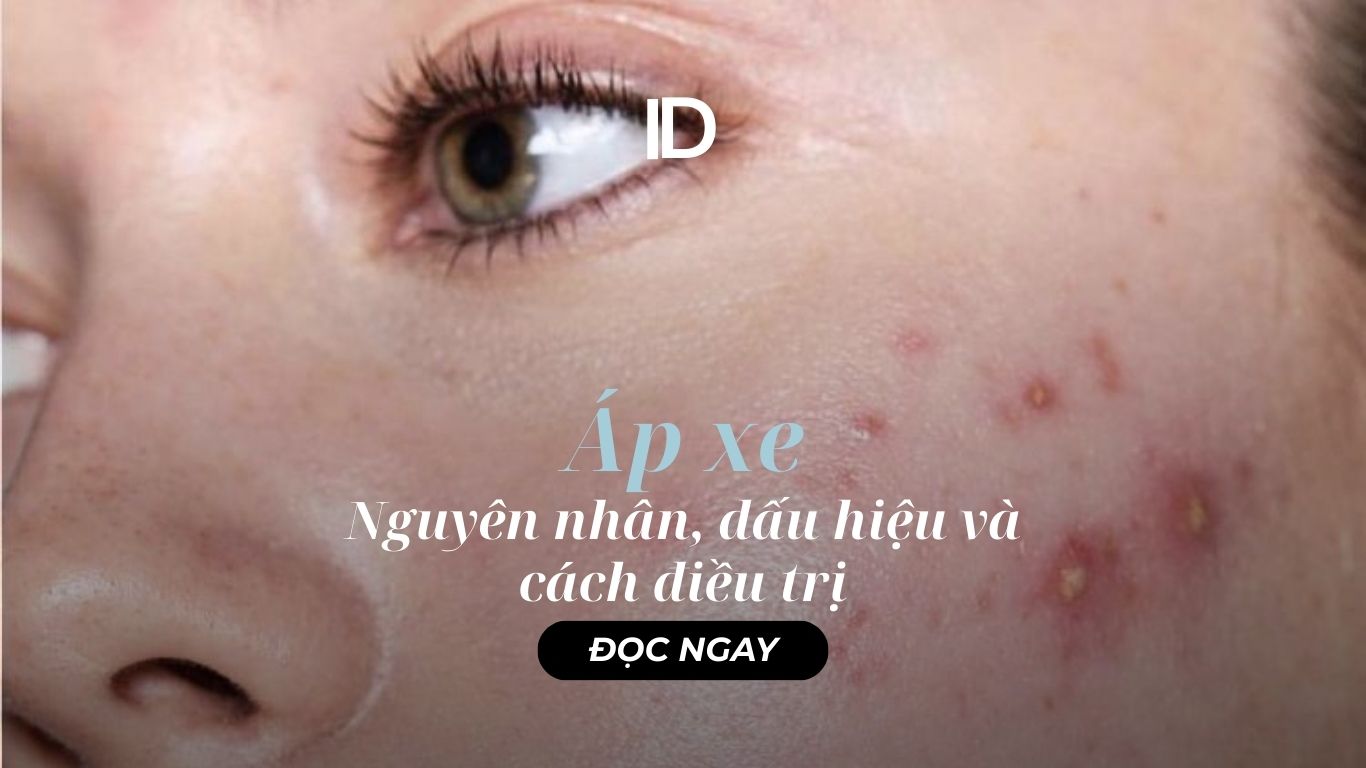 ÁP – XE LÀ GÌ? NGUYÊN NHÂN, DẤU HIỆU VÀ CÁCH ĐIỀU TRỊ