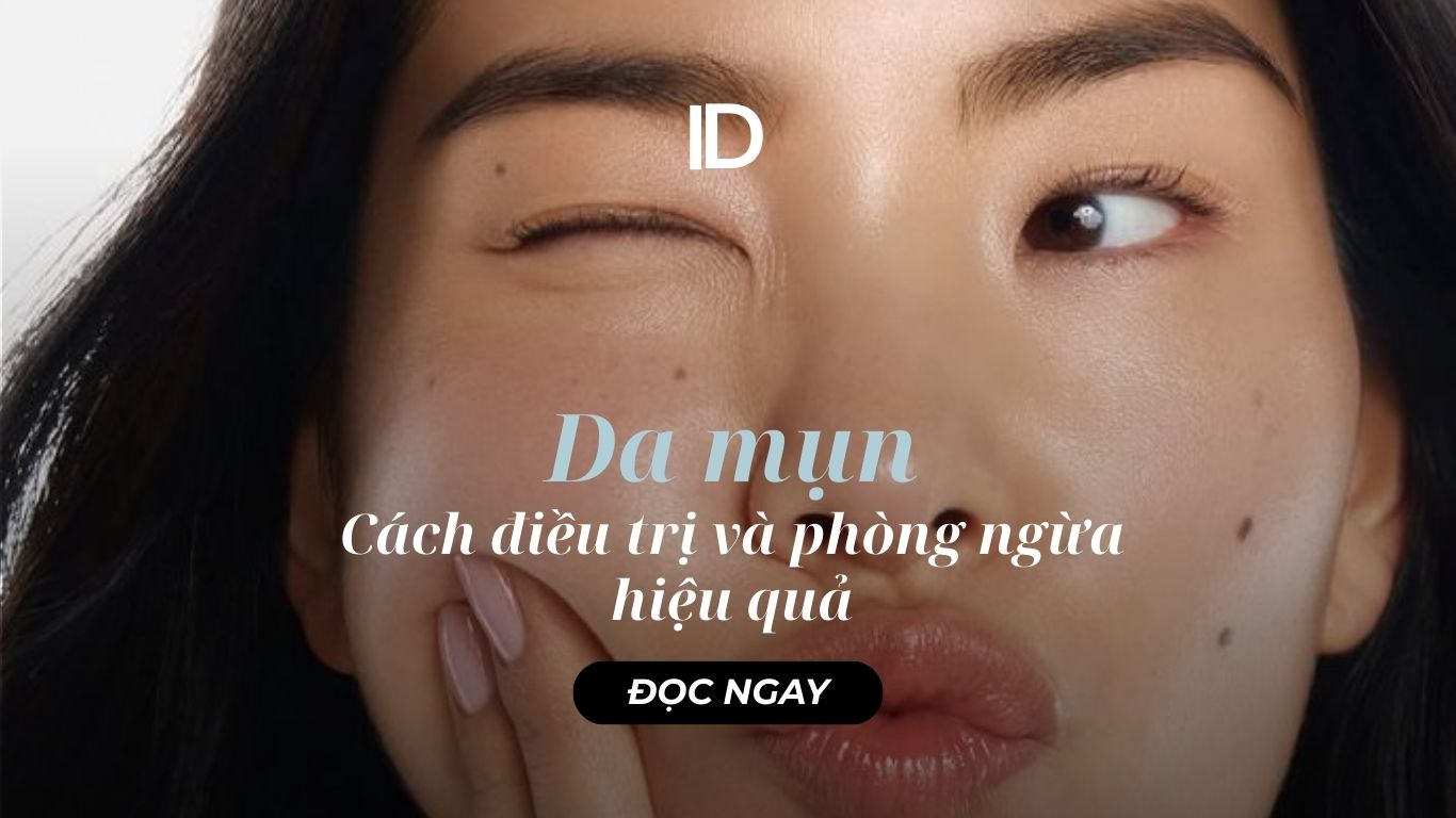 CÁCH ĐIỀU TRỊ VÀ PHÒNG NGỪA DA MỤN HIỆU QUẢ