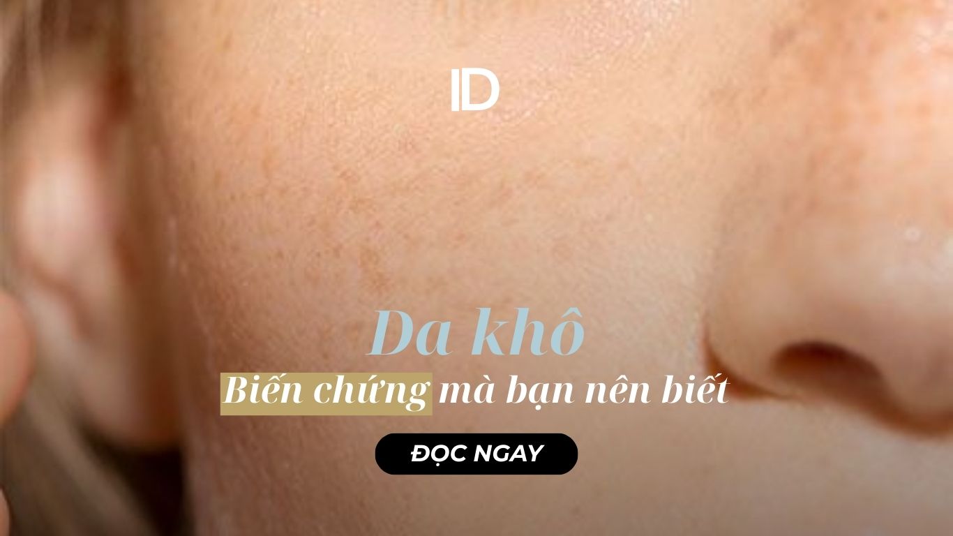 BIẾN CHỨNG CỦA DA KHÔ MÀ BẠN NÊN BIẾT