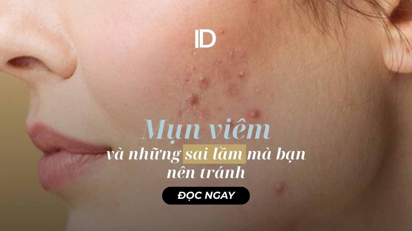MỤN VIÊM VÀ NHỮNG SAI LẦM MÀ BẠN NÊN TRÁNH
