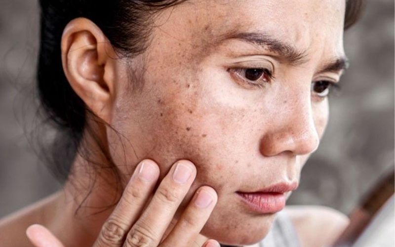 Làn da đã bị lão hóa sớm
