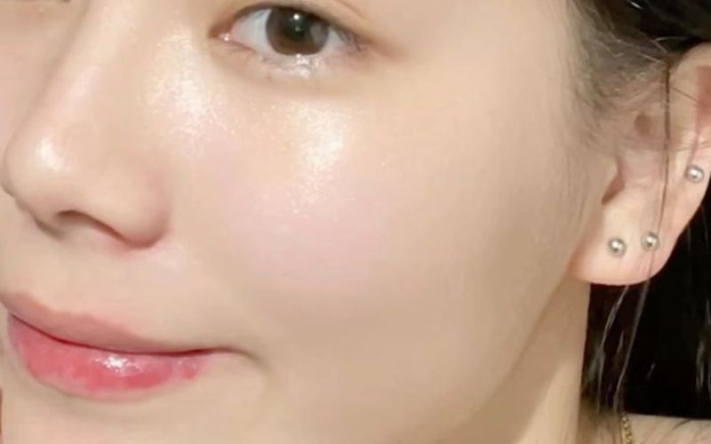 Đây là điển hình của làn da căng bóng, hồng hào