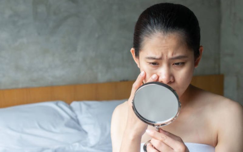Skincare sai cách cũng là nguyên nhân gây bí tắc da