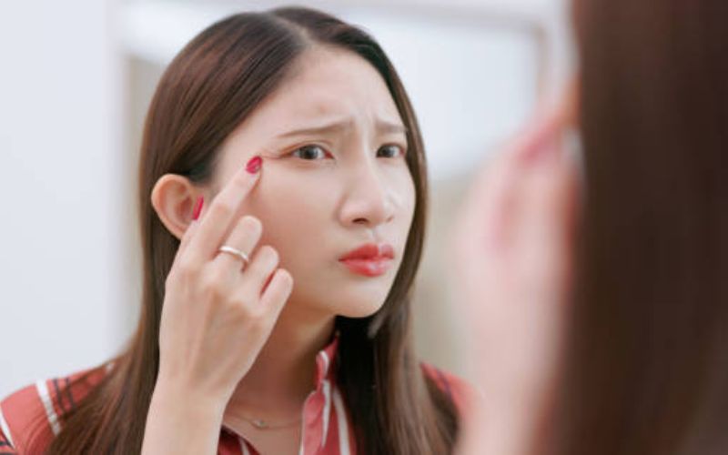 Tình trạng lão hóa da ngoại sinh