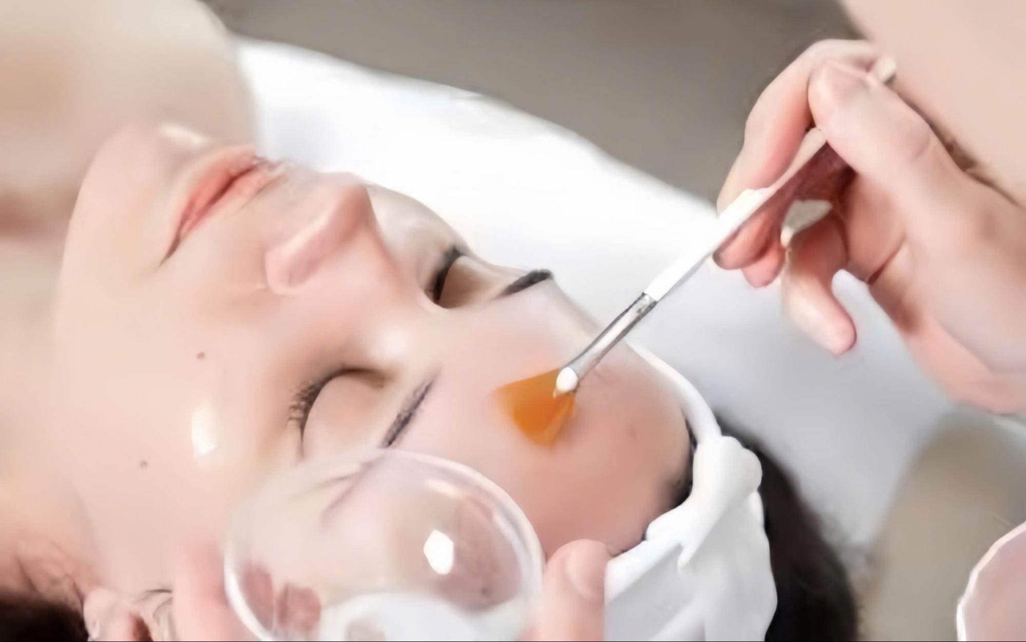 Ví dụ liệu trình peel nhẹ