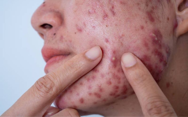 Làn da cần được can thiệp bởi bác sĩ