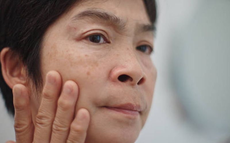 Tình trạng lão hóa da nội sinh
