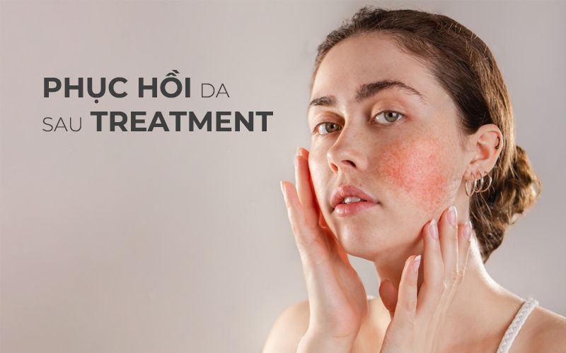 Hãy tham khảo các dòng sản phẩm để phục hồi da của chính mình